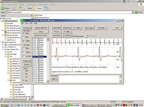 Ecg For Windows Xp Export Data To Txt Files Codeproject