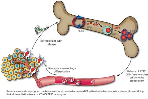 atf3 reprograms the bone marrow niche in response to early breast cancer transformation cancer