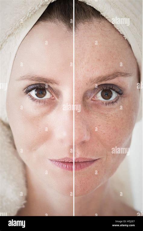 Beauty Concept Skin Care Anti Aging Procedures Rejuvenation