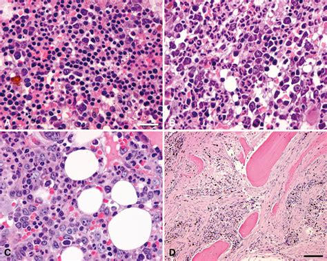 Figure 5 From Histologic And Cytologic Bone Marrow Findings In Dogs