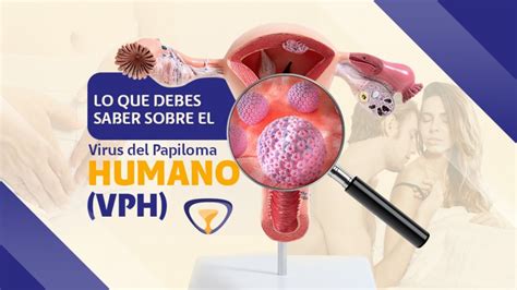 Lo Que Debes Saber Sobre El Virus Del Papiloma Humano Vph Nacer Centro De Reproducci N Asistida