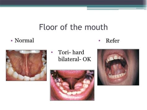 Ppt The Oral Systemic Link Powerpoint Presentation Id2098245