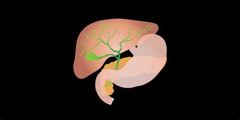 Laparoscopic Cholecystectomy Surgery 101