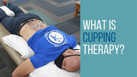 What Is Cupping Therapy Myofascial Decompression