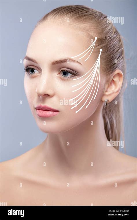 Spa Portrait Of Attractive Woman With Arrows On Her Face Face Lifting Concept Plastic Surgery
