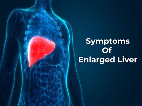 Hepatomegaly Enlarged Liver Is A Serious Condition You Shouldnt