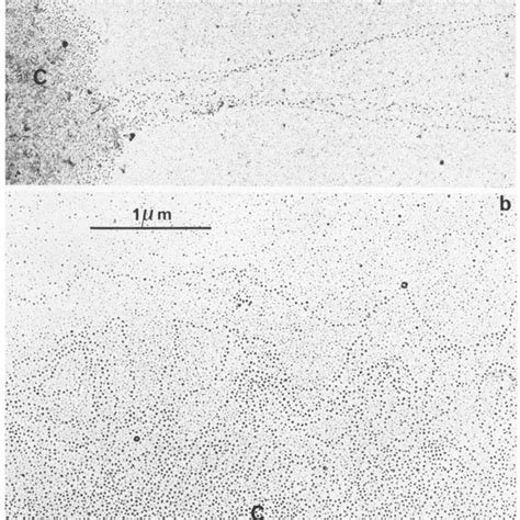 Electron Micrographs Of Spread Preparations Of Drosophila Salivary