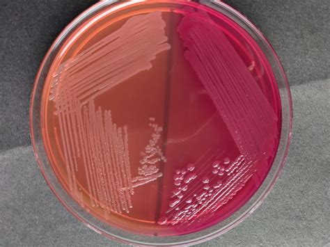 Macconkey Agar Composition Uses Colony Characteristics • Microbe Online