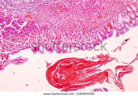 Tissue Stomach Under Microscopic Physiology Stomach Stock Photo