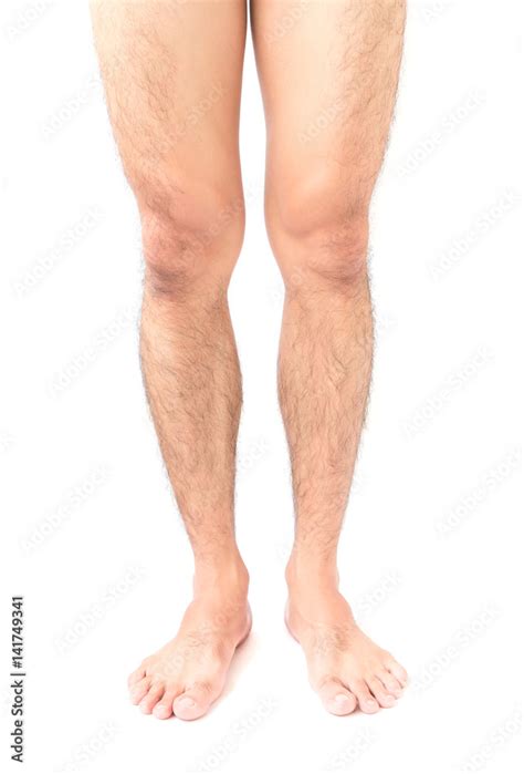 Closeup Legs Men Skin And Hairy With White Background Health Care And