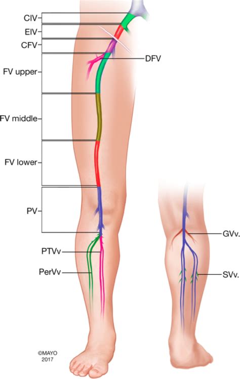 The Femoral Vein Becomes The External Iliac Vein When It