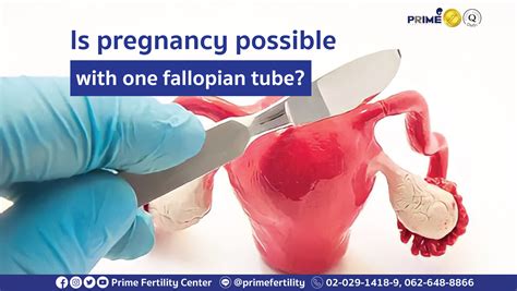 Is Pregnancy Possible With One Fallopian Tube Prime Fertility Clinic