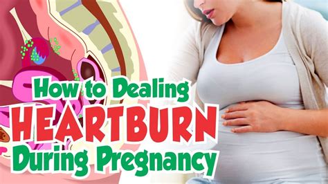 Natural Ways To Deal With Heartburn During Pregnancy Best Treatment For Pregnant Woman Youtube