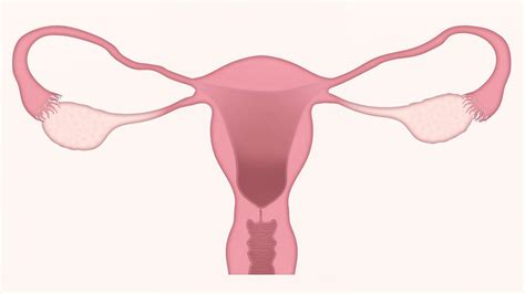 Polycystic Ovary Syndrome Causes And Natural Treatment