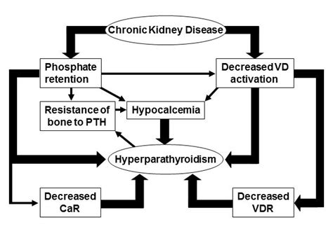 Pathogenesis And Treatment Of Chronic Kidney Disease Mineral And Bone