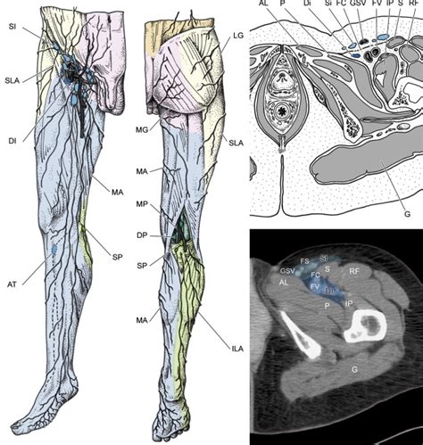 Anatomical Bases For The Radiological Delineation Of Lymph Node Areas
