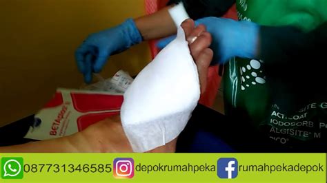 Beberapa jam usai operasi, rasa sakit pada bagian sayatan bisa terasa begitu nyeri. Cara Merawat Luka | Cara Menggulung Verban | Punya Luka ...