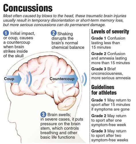 Scary Statistics About Concussions Traumatic Brain Injury Brain