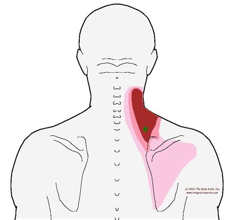 Trigger Points Stiffness Up The Side Of The Neck Trigger Points
