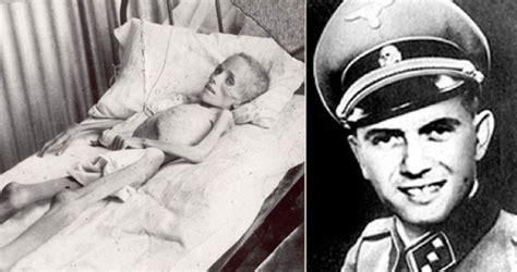 Pokusy Na Dvojčatech I Chemické Experimenty Josefa Mengeleho Si Můžete Prohlédnout V Národním