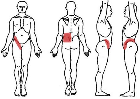 A strike to the lower back can damage the kidneys of the person being hit. Kidney Pain - (Location, anatomy), lower back, Vs Back ...