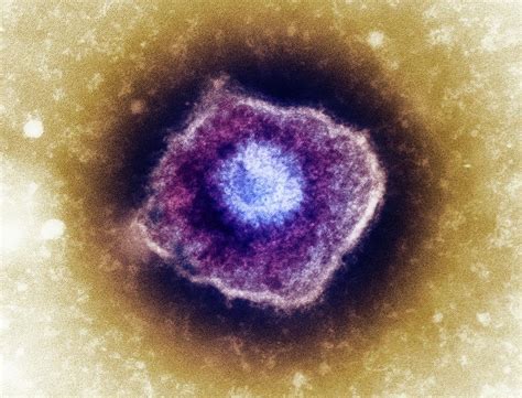 Varicella Zoster Virus Particle Photograph By Heather Daviesscience