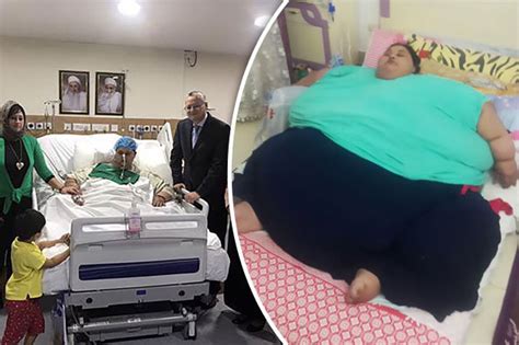 Worlds Fattest Woman Loses 38 Stone After Shock Weight Loss Surgery Daily Star
