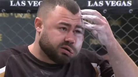 Competitors Face Left Disfigured After Brutal 30 Minutes Of Slap Fighting
