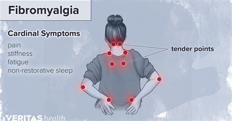 Physical Therapy For Fibromyalgia Hastie Financial Group