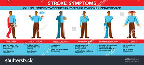 Stroke Medical Infographic Illustrations Major Stroke Vector Có Sẵn