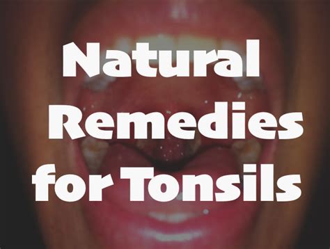 9 Natural Remedies For Tonsillitis Swollen Tonsils Natural Sleep
