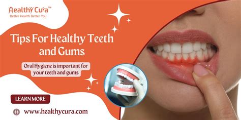 Tips For Healthy Teeth And Gums Healthy Cura Posteezy