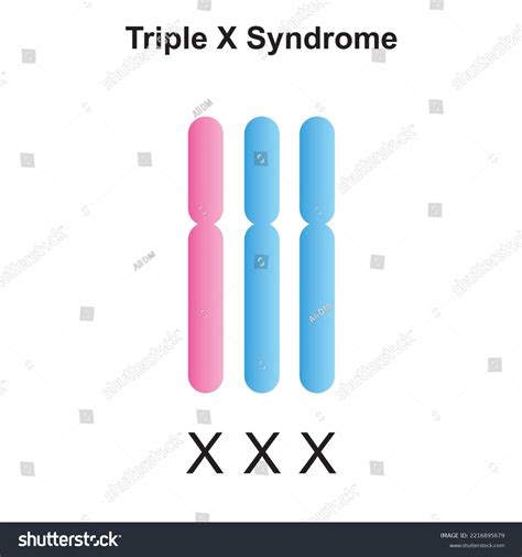 Scientific Designing Triple X Syndrome Trisomy เวกเตอร์สต็อก ปลอดค่าลิขสิทธิ์ 2216895679