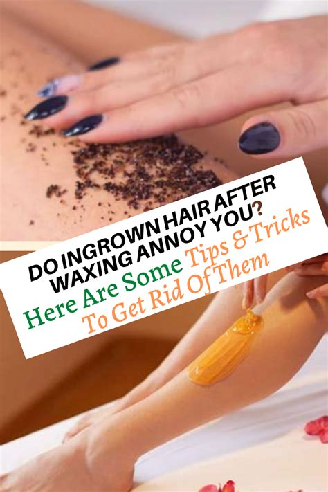 Do Ingrown Hair After Waxing Annoy You Here Are Some Tips And Tricks To