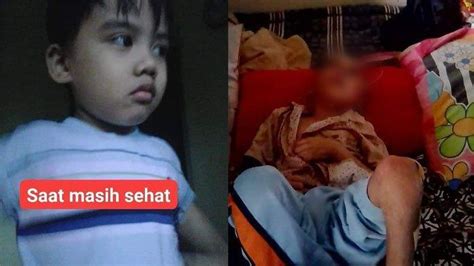 Viral Bocah 7 Tahun Di Bandung Diduga Dianiaya Orangtua Kandung Hingga