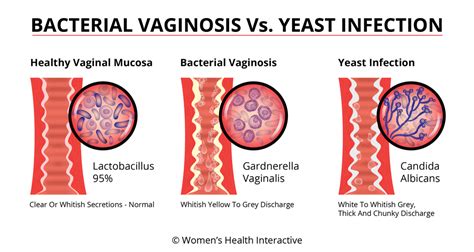 Yeast Infection In Groin Area Pictures What Does A Yeast Infection Look Like Examples And