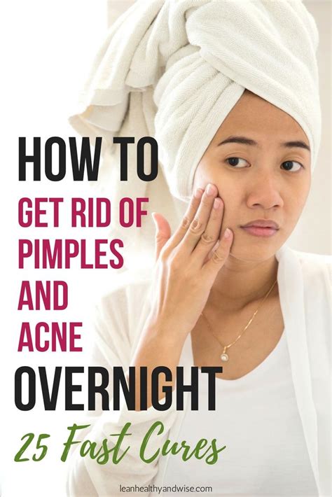 How To Get Rid Of Pimples And Acne Overnight 25 Fast Cures Effective
