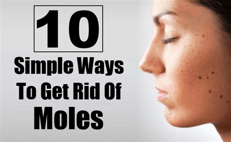 What are the best methods to get rid of moles? 10 Simple Ways To Get Rid Of Moles On Any Part Of The Body ...