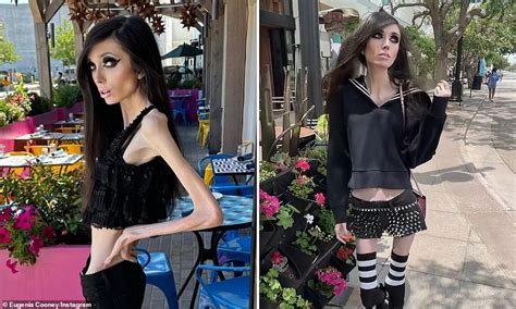 Anorexic Youtuber 29 Prompts Backlash After Sharing New Images
