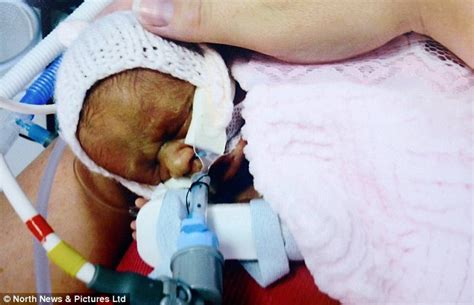 premature twins separated while one battled for her life are reunited daily mail online
