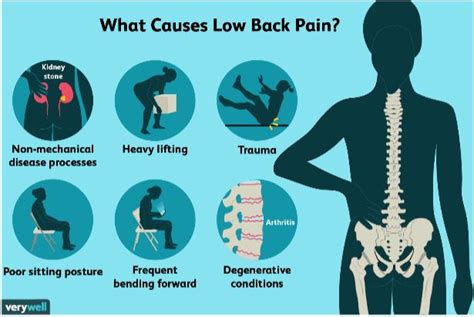 What Causes Lower Back Pain Strive Physical Therapy Centers
