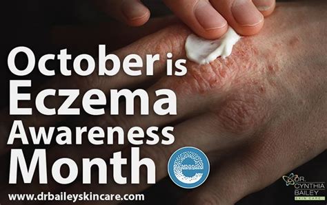 October Is Eczema Awareness Month Eczema Awareness Month Awareness