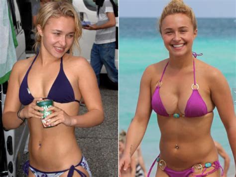 Breast Augmentation Before And After Celebrity Edition Atlantic
