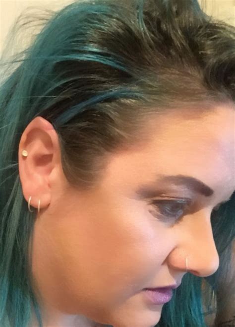Woman Spends £1000 On Elf Ears Implants For Her Wedding Day Metro News