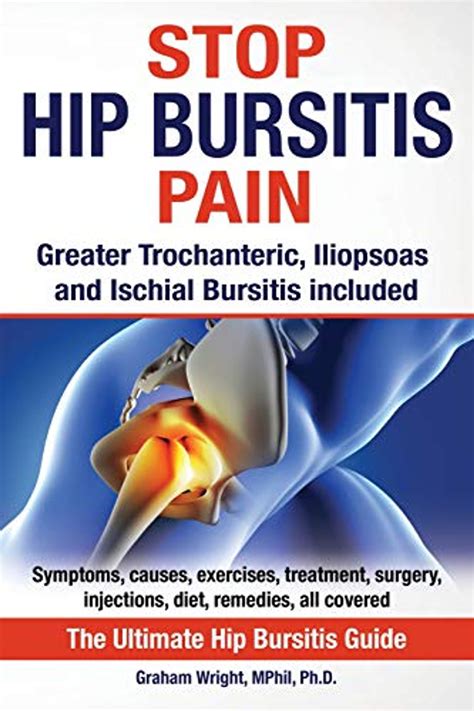 Hip Bursitis Iliopsoas