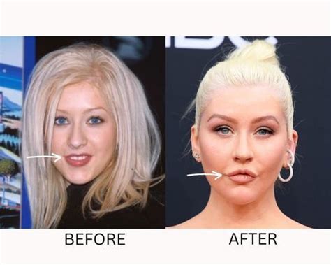 Christina Aguilera Plastic Surgery Secrets Know Everything Fabbon