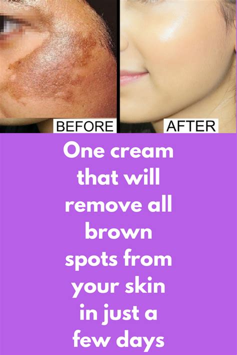 One Cream That Will Remove All Brown Spots From Your Skin In Just A Few