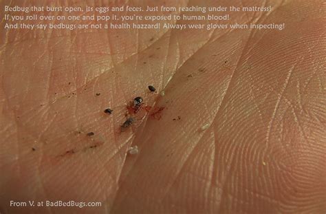 Picture of a bed bug in hair. Bed Bug Control. Fleas In Bed Pictures. www.e-bedbugs.com ...
