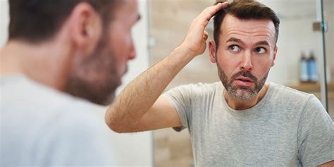 Hereditary hair loss is permanent, if left to run its own course. Hair Loss - Tricho Solutions