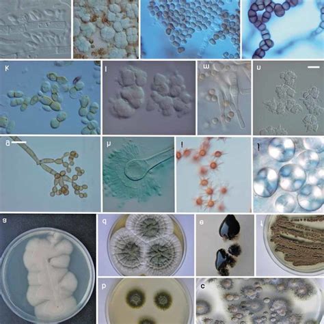 Morphology Of Fungal Colonies Af And Microscopic Structures Of